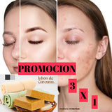 PROMOCIÓN 3 X 1 JABÓN DE CÚRCUMA
