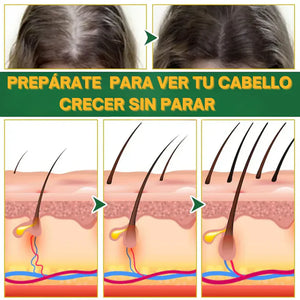 OUHOE SPRAY - PARA CRECIMIENTO DE CABELLO